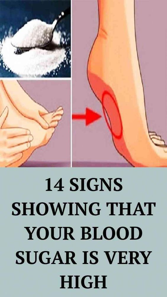 14 Signs Showing That Your Blood Sugar Is Very High