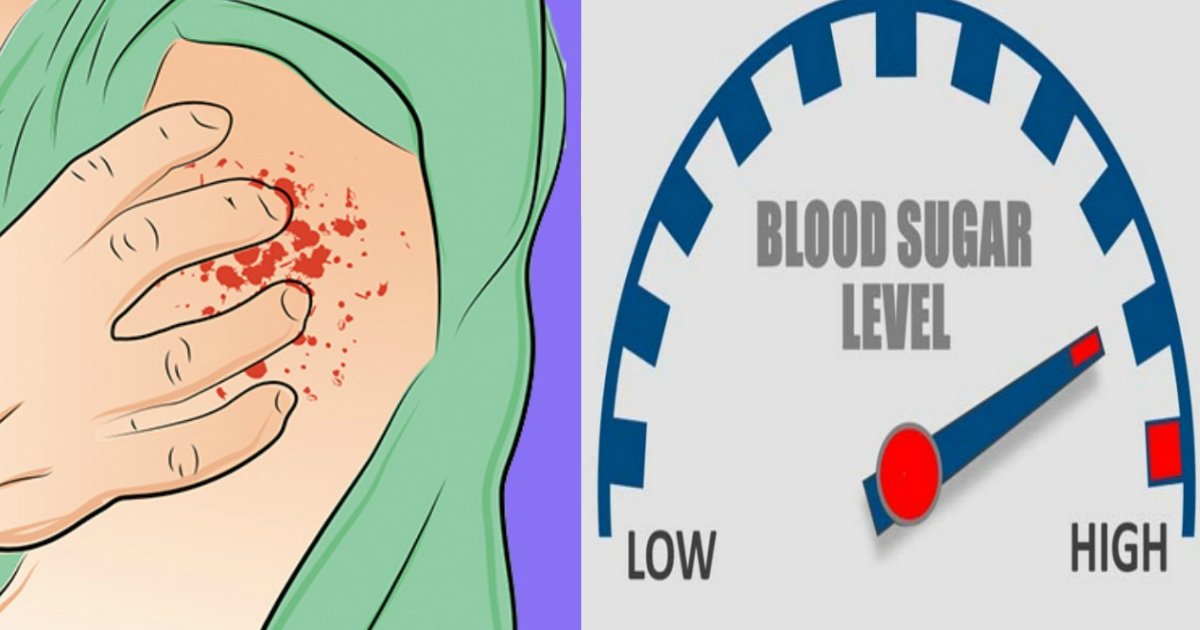 16 Symptoms That Indicate Your Blood Sugar Level Is Too ...