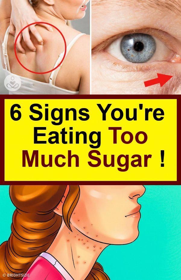 6 Signs You re Eating Too Much Sugar ! in 2020