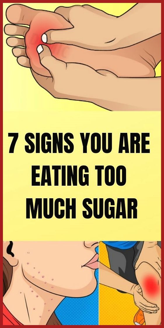 7 Signs You Are Eating Too Much Sugar!