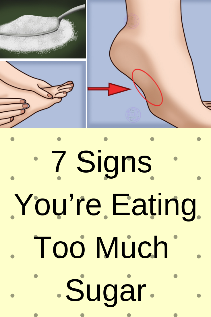 7 Signs Youâre Eating Too Much Sugar