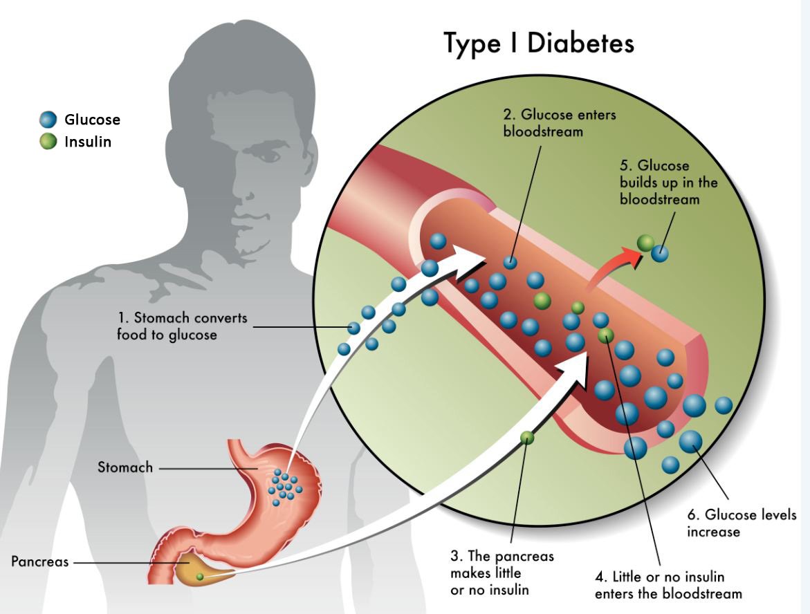 About Diabetes