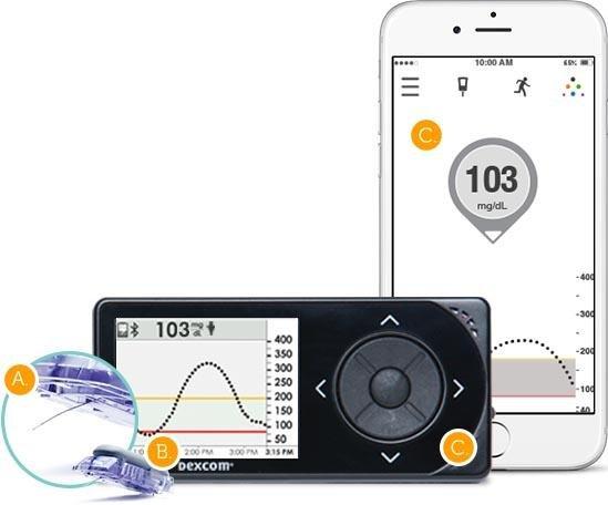 Are Insulin Pump Supplies Covered By Medicare ...