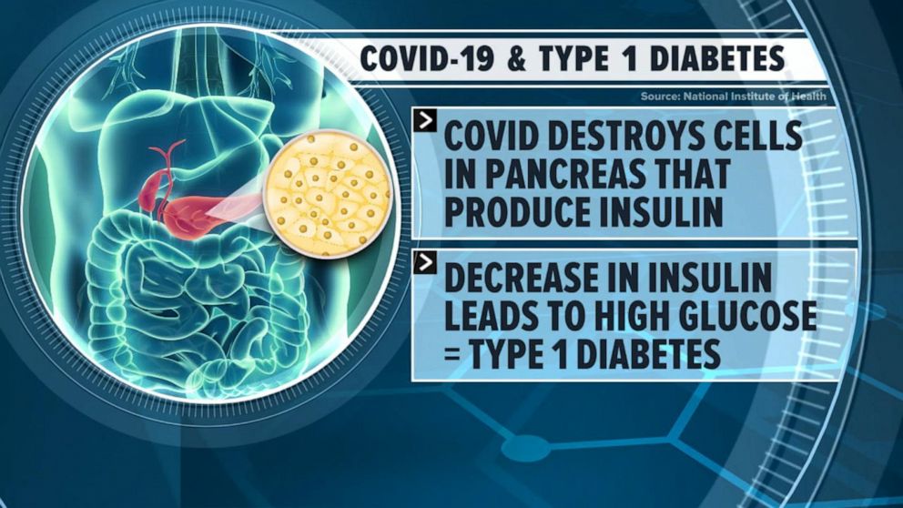 Can You Develop Type 1 Diabetes