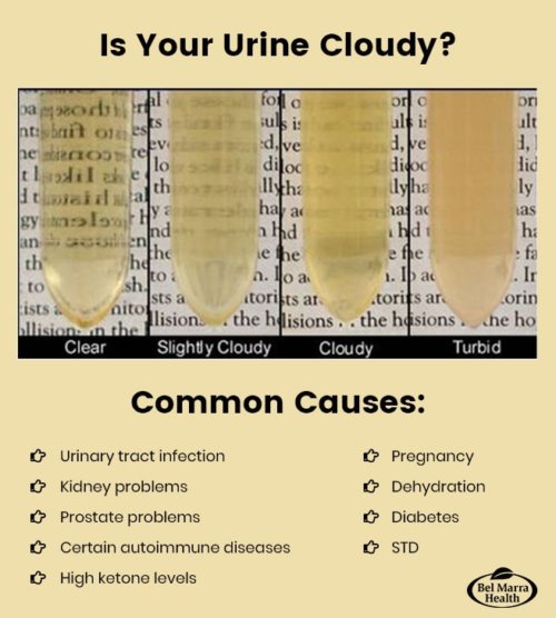 Common Causes of Cloudy Urine &  Treatment Tips