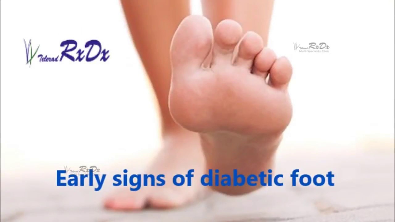 Diabetes And Feet