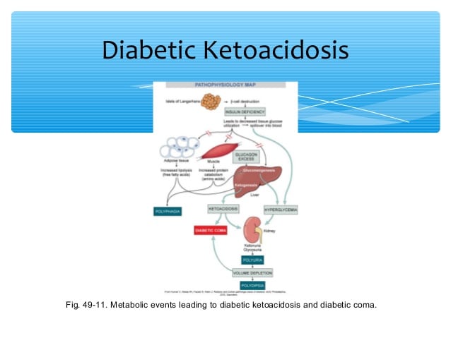 Diabetes lecture fall 2014