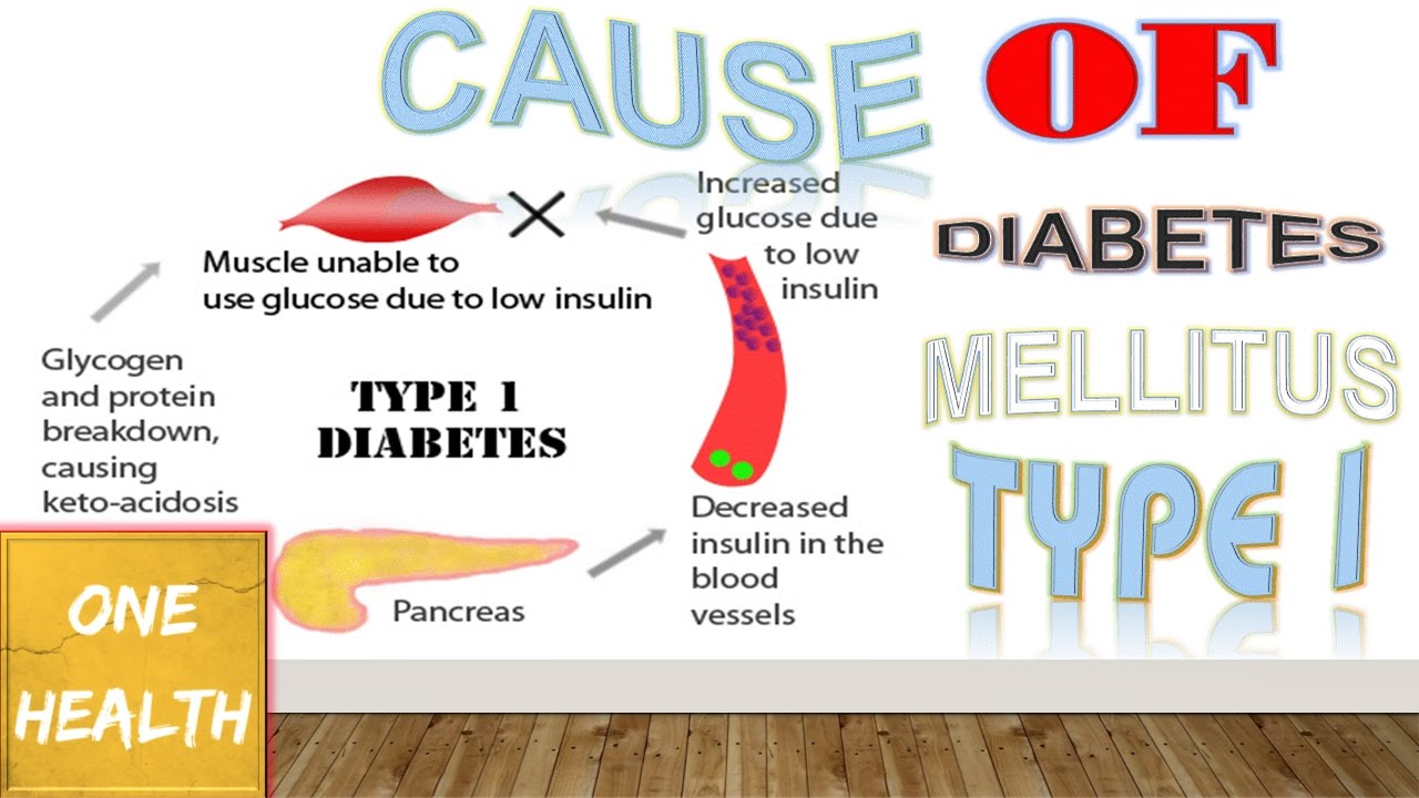 Diabetes mellitus type 1