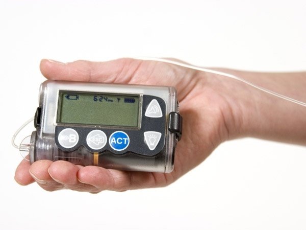 Diabetes Treatment: Pros and Cons of Insulin Pumps ...