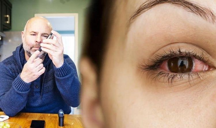 Diabetes type 2: High blood sugars and the eyes  glaucoma ...