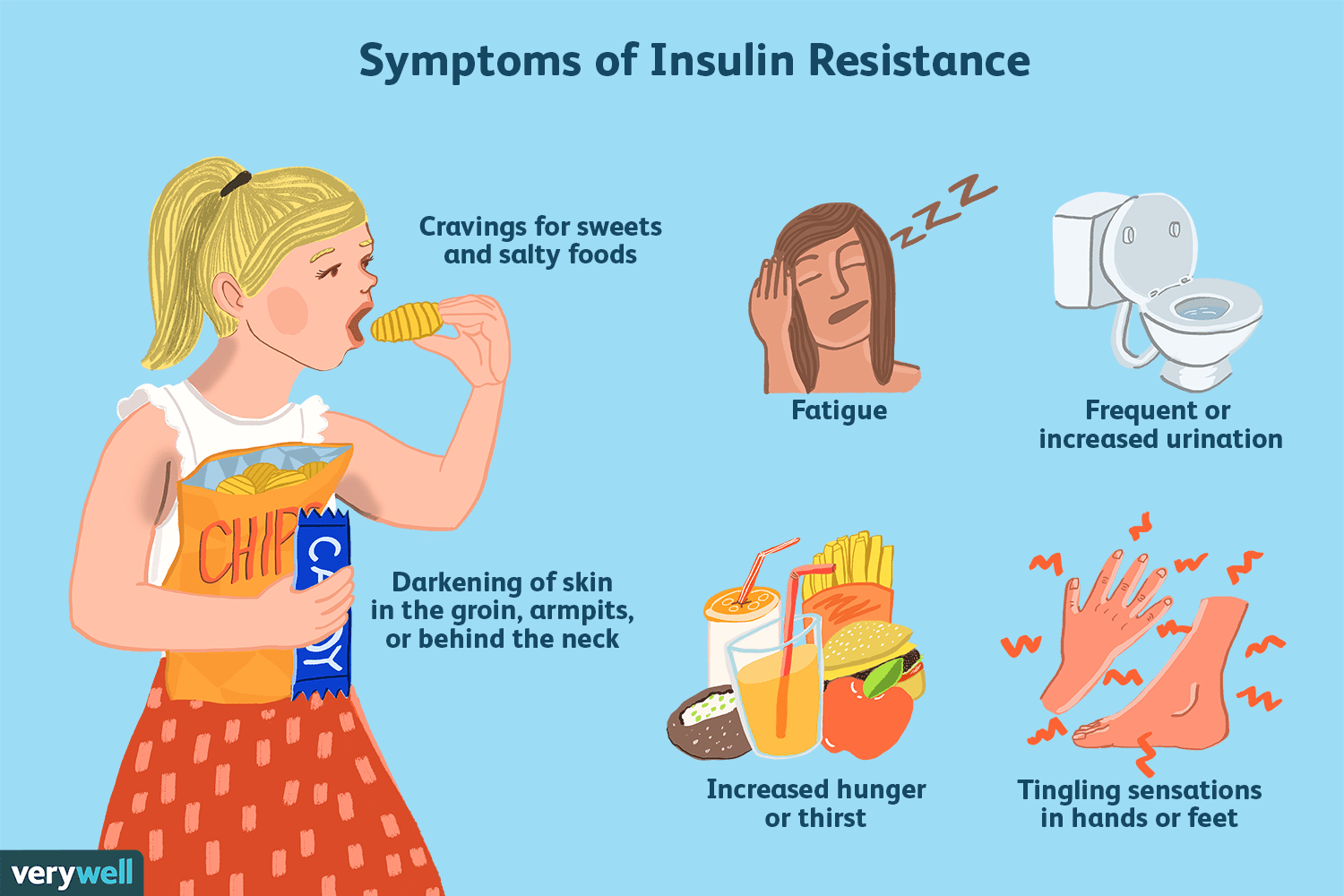 Diagnosing Insulin Resistance in Women With PCOS