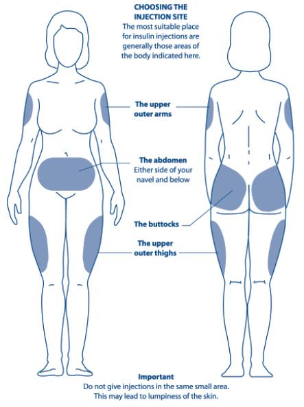 Diagram showing the areas of the body most suitable for ...