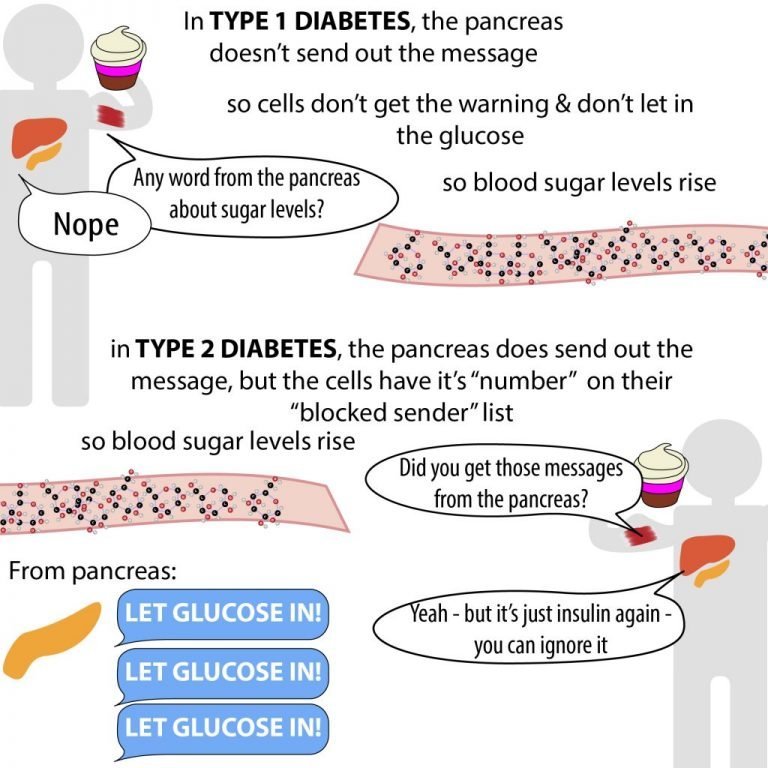 Does Type 2 Diabetes Require Insulin â Diabetes Care Talk