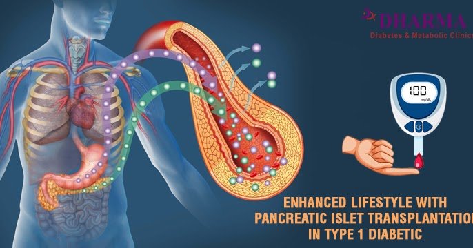 Enhanced Lifestyle with Pancreatic Islet Transplantation ...