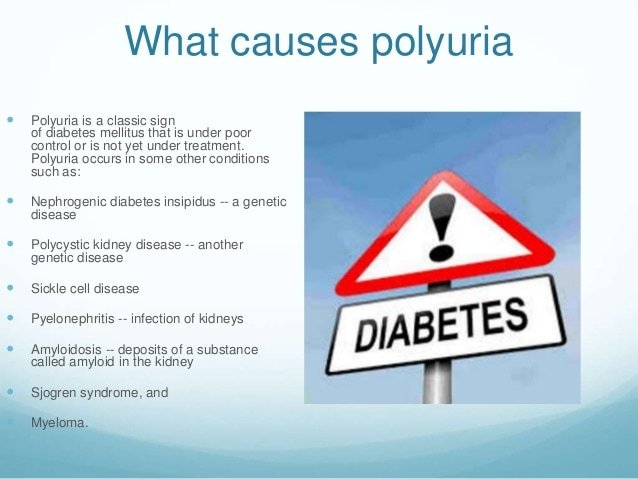 Glycosuria and Polyuria slide show