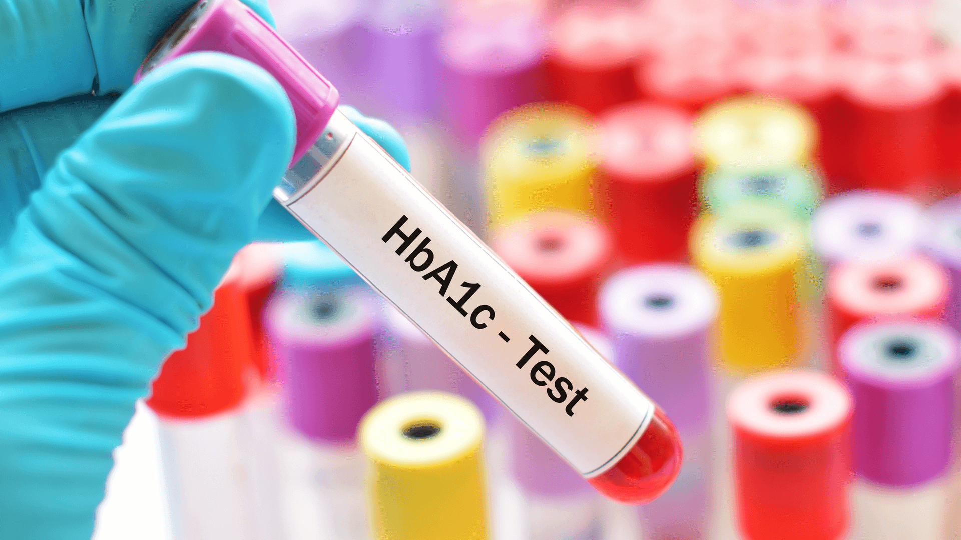 HbA1c: A Test Every Diabetic Should Know About