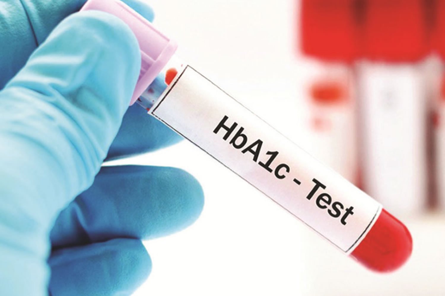 HbA1c chart, HbA1c test, normal HbA1c level and HbA1c ...