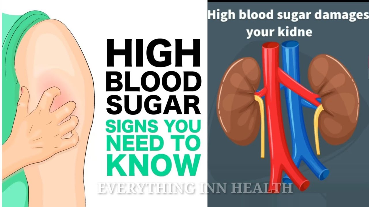 High Blood Sugar, Signs And Symptoms You Need To Know ...
