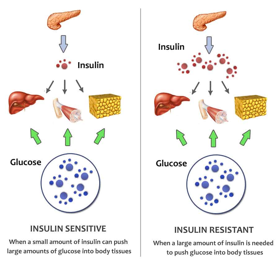 How Fat Kills Insulin