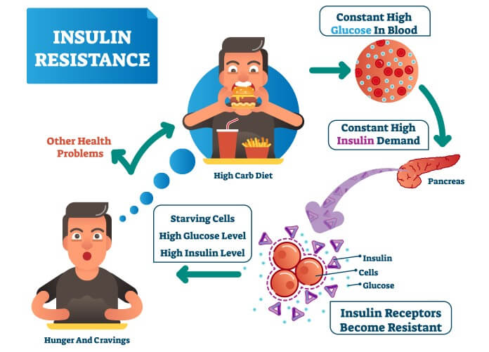 How to Cope with Insulin Resistance?