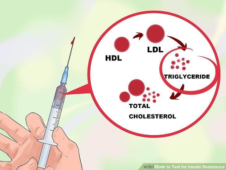 How to Test for Insulin Resistance: 10 Steps (with Pictures)