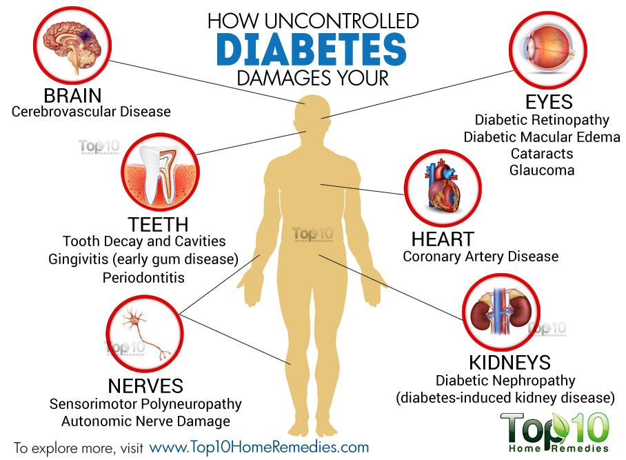 How Uncontrolled Diabetes Damages Your Heart, Eyes ...