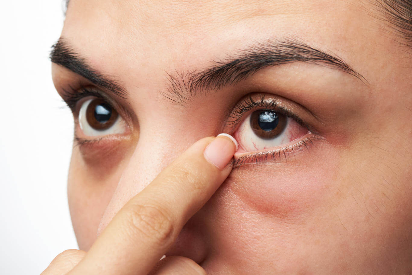 Is Diabetes Affecting Your Eyes? 7 Signs of Diabetic Eyes