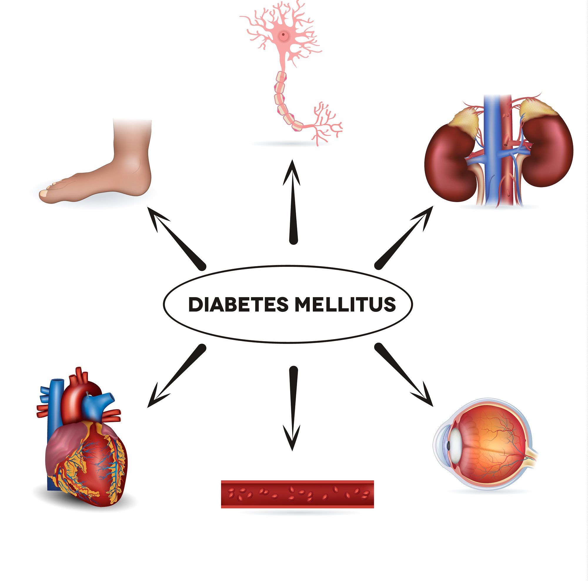 ITS DIABETIC QUIZ TIME HOW MUCH DO YOU KNOW ABOUT HOW ...