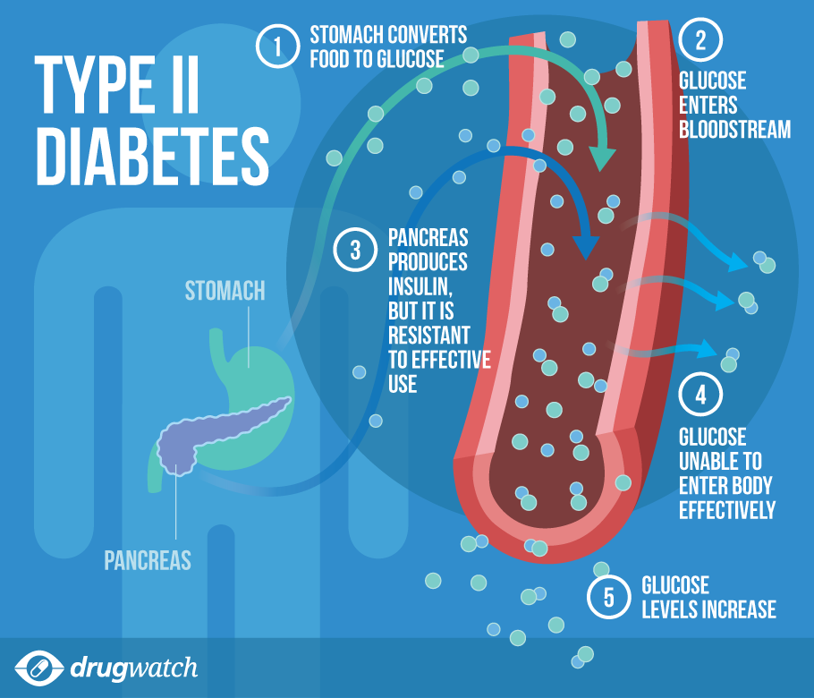 Precisely what are The Symptoms of Diabetes mellitus type ...