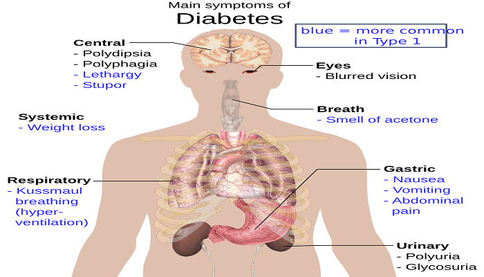 The 8 Most Common Type 2 Diabetes Symptoms