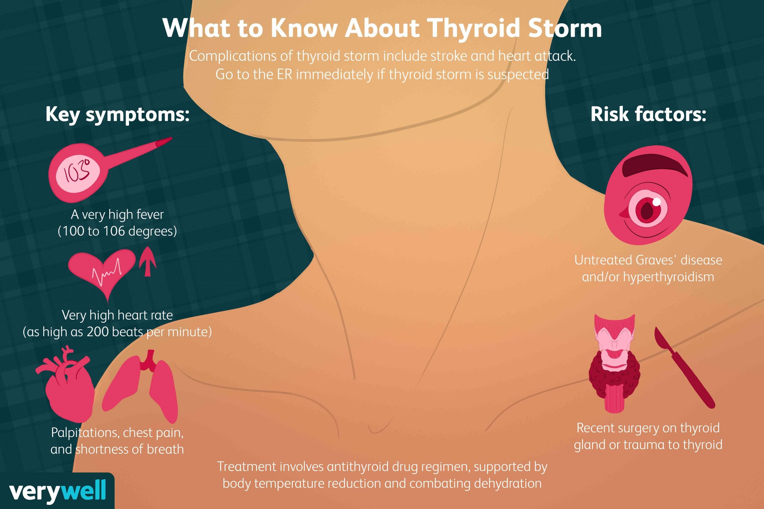 Thyroid Storm: Symptoms, Causes, Diagnosis, Treatment