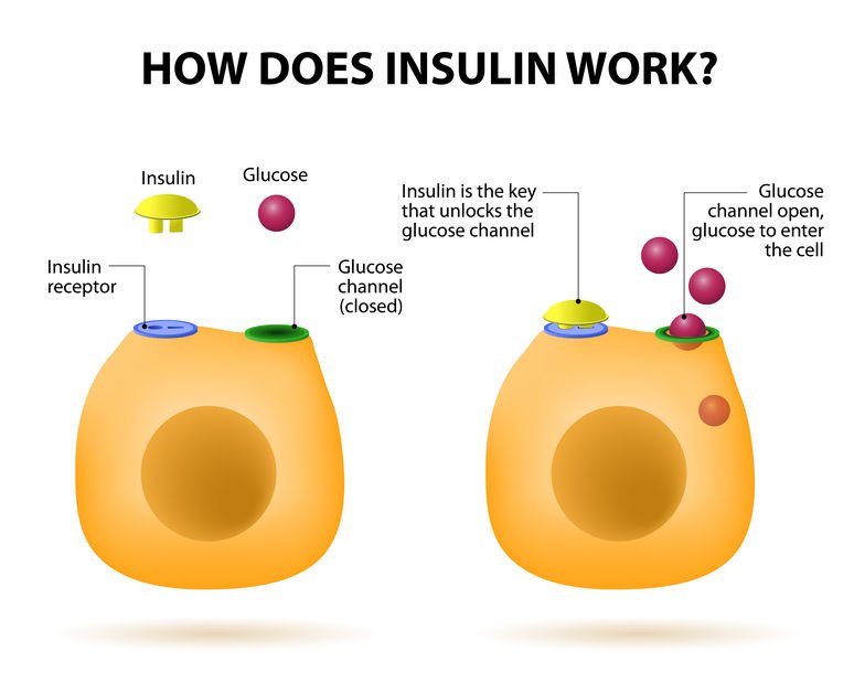 Type 1 Diabetes and Insulin