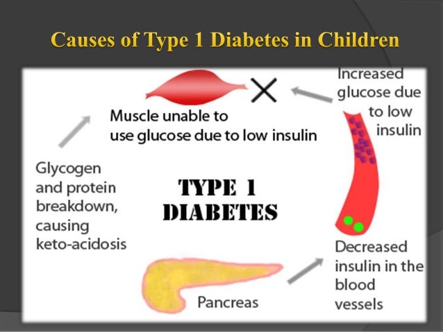 Type 1 diabetes in children Symptoms and causes