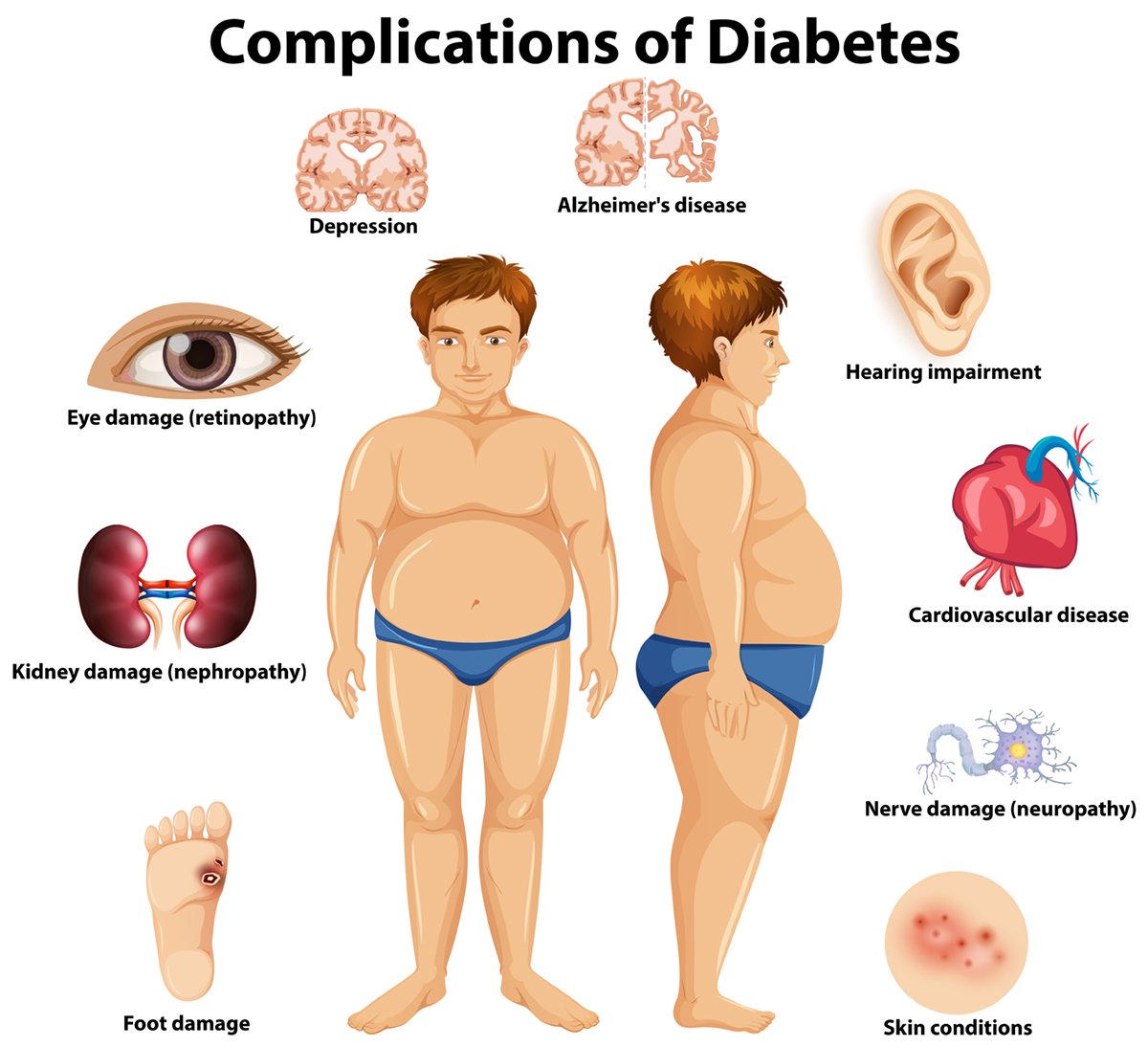 Types of Diabetic Neuropathy