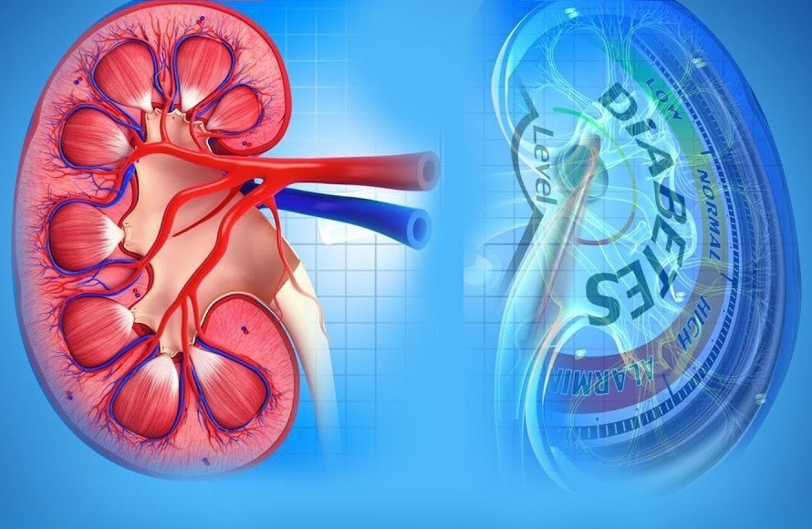Wellness Tips: How Does Diabetes Affect Kidney Health?