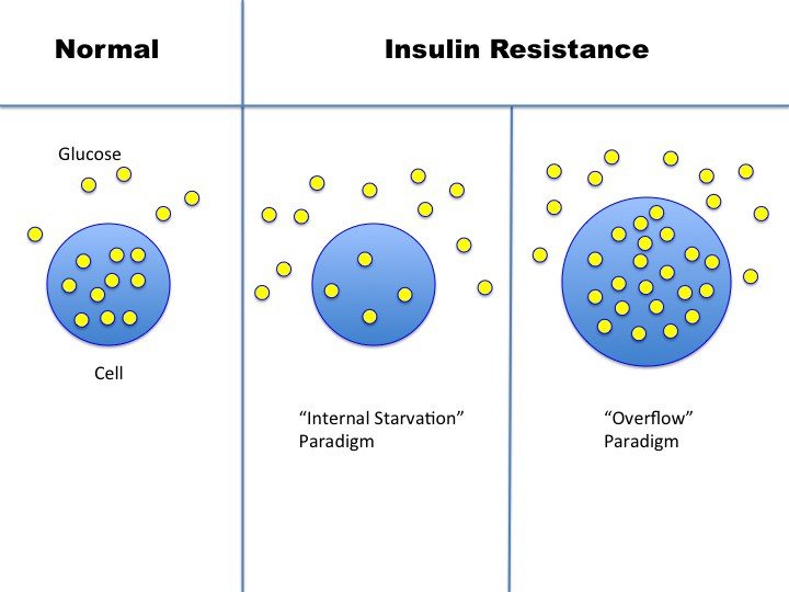What, exactly is insulin resistance?