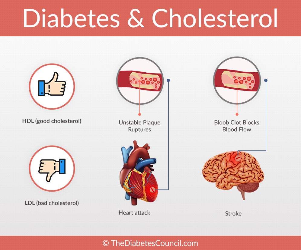 Why are cholesterol levels high  Health News