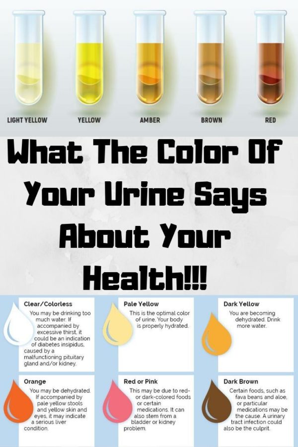 Why is Urine Yellow?? Do You know?